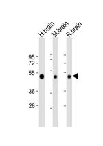 NPTX1 Antibody in Western Blot (WB)