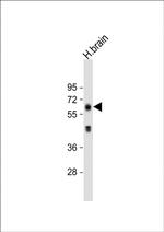 EHD3 Antibody in Western Blot (WB)