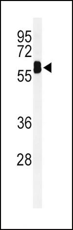 EHD3 Antibody in Western Blot (WB)