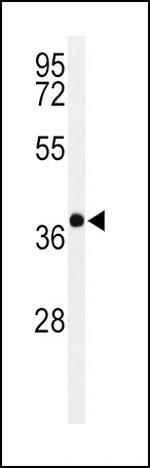 PAX6 Antibody in Western Blot (WB)