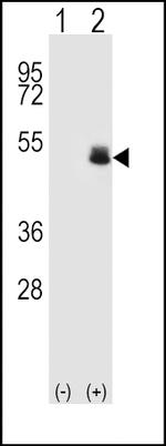 PAX6 Antibody in Western Blot (WB)