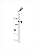 CSF1R Antibody in Western Blot (WB)