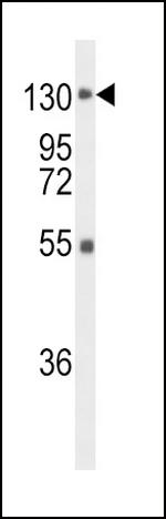 FGFR1 Antibody in Western Blot (WB)