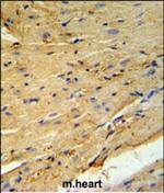 Phospholamban Antibody in Immunohistochemistry (Paraffin) (IHC (P))