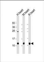 Phospholamban Antibody in Western Blot (WB)