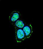 JIP1 Antibody in Immunocytochemistry (ICC/IF)