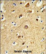 JIP1 Antibody in Immunohistochemistry (Paraffin) (IHC (P))