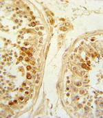 SFRP1 Antibody in Immunohistochemistry (Paraffin) (IHC (P))