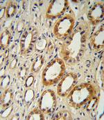 CYP27B1 Antibody in Immunohistochemistry (Paraffin) (IHC (P))