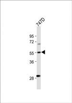 CYP27B1 Antibody in Western Blot (WB)