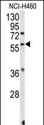 ESRRB Antibody in Western Blot (WB)