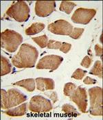 Neuropilin 1 Antibody in Immunohistochemistry (Paraffin) (IHC (P))