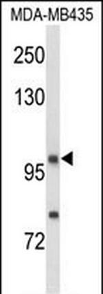 Neuropilin 1 Antibody in Western Blot (WB)