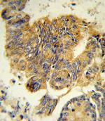 CSF3R Antibody in Immunohistochemistry (Paraffin) (IHC (P))