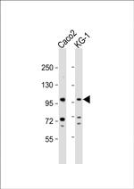 CSF3R Antibody in Western Blot (WB)