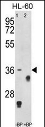 TNFRSF14 Antibody in Western Blot (WB)