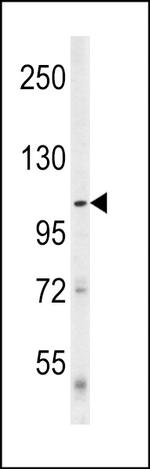 ULK1 (denatured) Antibody in Western Blot (WB)