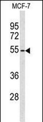 ADAMDEC1 Antibody in Western Blot (WB)