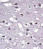 OPRM1 Antibody in Immunohistochemistry (Paraffin) (IHC (P))