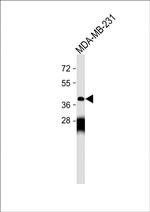 OPRM1 Antibody in Western Blot (WB)