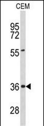 PEX16 Antibody in Western Blot (WB)