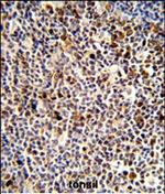 KIR3DL3 Antibody in Immunohistochemistry (Paraffin) (IHC (P))