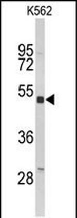 KIR3DL3 Antibody in Western Blot (WB)