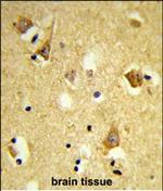 APOBEC3F Antibody in Immunohistochemistry (Paraffin) (IHC (P))