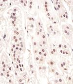 Cdc73 Antibody in Immunohistochemistry (Paraffin) (IHC (P))