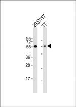 Cdc73 Antibody in Western Blot (WB)