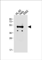 FCGR1B Antibody in Western Blot (WB)