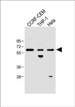 FCGR1B Antibody in Western Blot (WB)