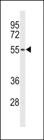 ASIC2 Antibody in Western Blot (WB)