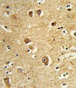 SLC22A6 Antibody in Immunohistochemistry (Paraffin) (IHC (P))