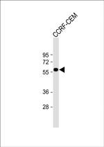 SLC22A6 Antibody in Western Blot (WB)