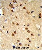 Ataxin 3 Antibody in Immunohistochemistry (Paraffin) (IHC (P))