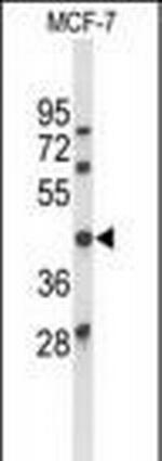 Ataxin 3 Antibody in Western Blot (WB)