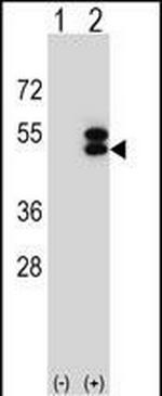 Ataxin 3 Antibody in Western Blot (WB)