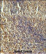 MEF2A Antibody in Immunohistochemistry (Paraffin) (IHC (P))