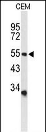 ASIC1 Antibody in Western Blot (WB)