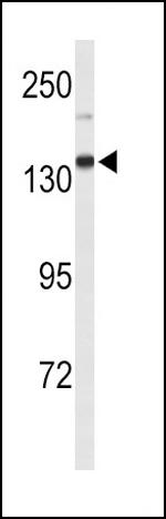 XDH Antibody in Western Blot (WB)