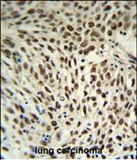 SNRPD3 Antibody in Immunohistochemistry (Paraffin) (IHC (P))