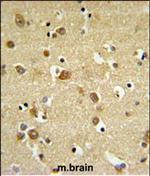 GABRD Antibody in Immunohistochemistry (Paraffin) (IHC (P))