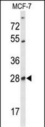 SELT Antibody in Western Blot (WB)