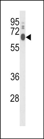 LPCAT1 Antibody in Western Blot (WB)