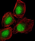 DLL3 Antibody in Immunocytochemistry (ICC/IF)