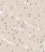 DLL3 Antibody in Immunohistochemistry (Paraffin) (IHC (P))