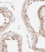 DLL3 Antibody in Immunohistochemistry (Paraffin) (IHC (P))