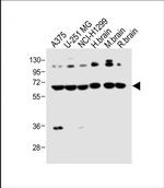 DLL3 Antibody in Western Blot (WB)