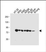 GUSB Antibody in Western Blot (WB)